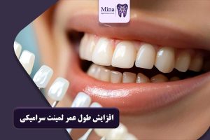 افزایش طول عمر لمینت سرامیکی