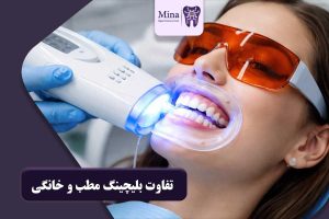تفاوت بلیچینگ مطب و خانگی