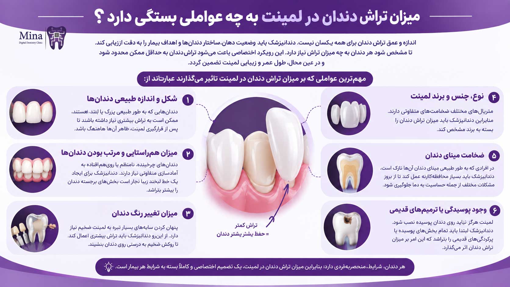 میزان تراش دندان در لمینت به چه عواملی بستگی دارد؟