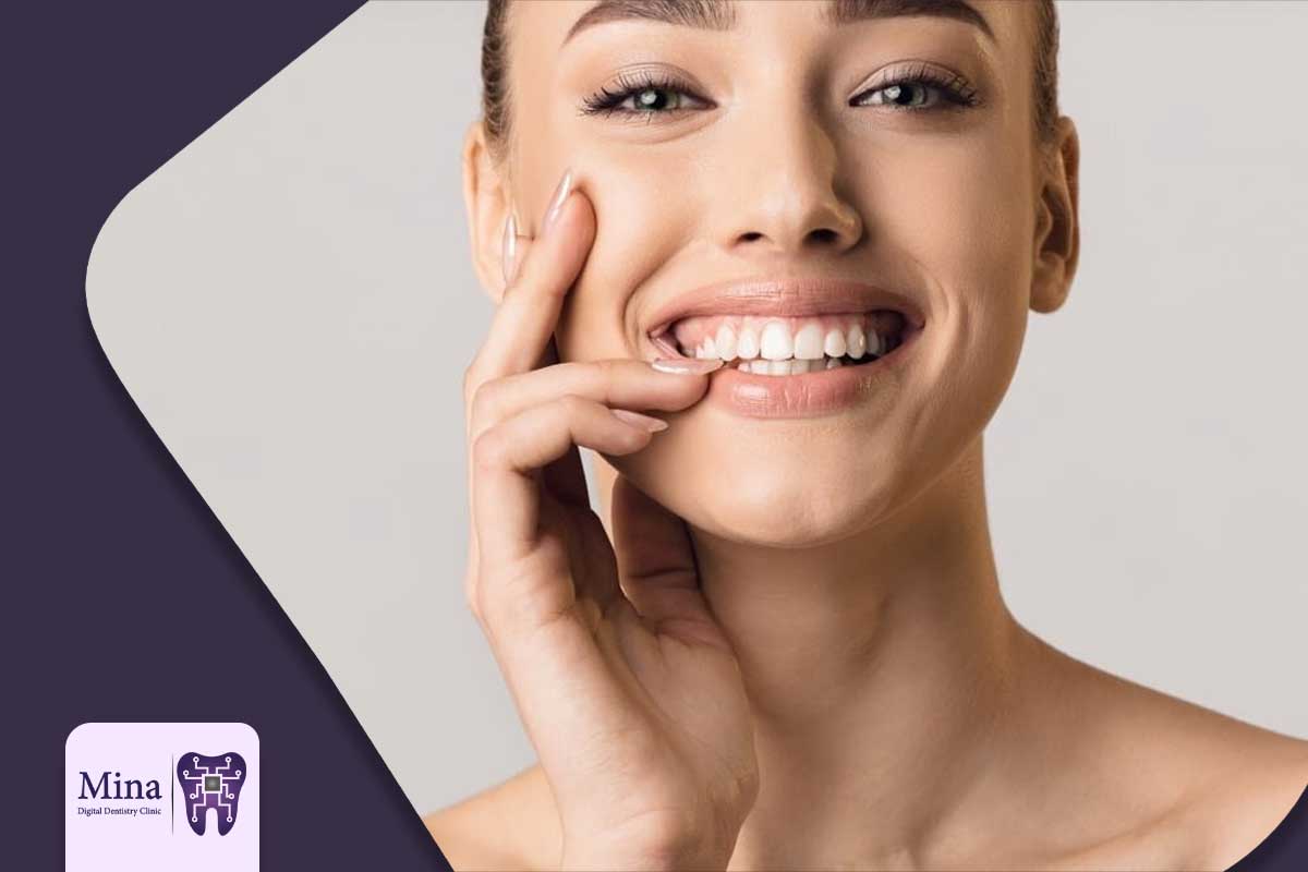 هزینه اصلاح لبخند لثه ای در تبریز