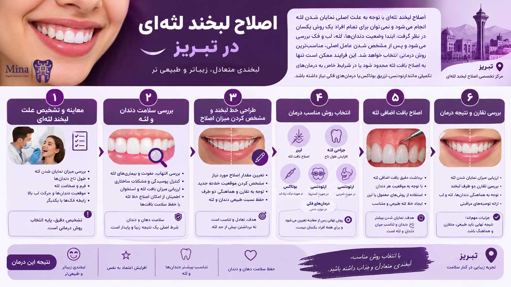 شیوه اصلاح لبخند لثه ای در تبریز